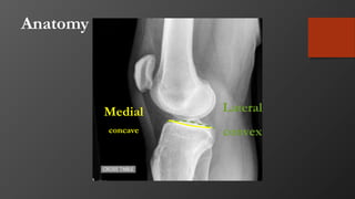 Anatomy
Medial
concave
Lateral
convex
 