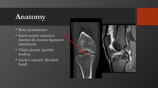Anatomy
• Bony prominences
• Intercondylar eminence
(menisci & cruciate ligaments
attachment)
• Tibial tubercle (patellar
tendon)
• Gerdy’s tubercle (Iliotibial
band)
 
