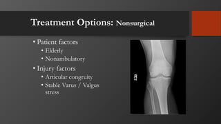Treatment Options: Nonsurgical
• Patient factors
• Elderly
• Nonambulatory
• Injury factors
• Articular congruity
• Stable Varus / Valgus
stress
 