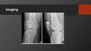 Imaging
 