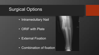 Surgical Options
• Intramedullary Nail
• ORIF with Plate
• External Fixation
• Combination of fixation
 