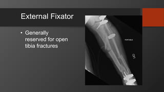 External Fixator
• Generally
reserved for open
tibia fractures
 