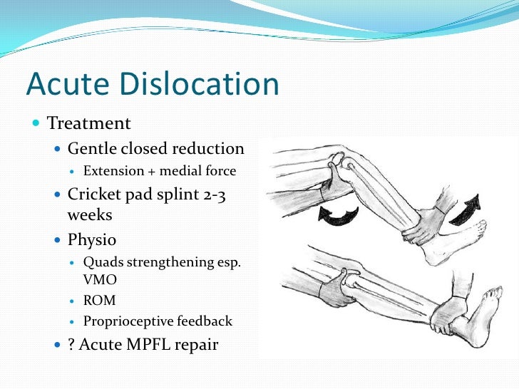 Patello femoral instability