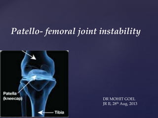 Patello- femoral joint instability
DR MOHIT GOEL
JR II, 28th Aug, 2013
 