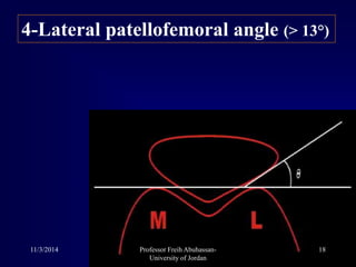 4-Lateral patellofemoral angle (> 13°)
11/3/2014 18Professor Freih Abuhassan-
University of Jordan
 