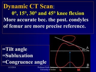 Dynamic CT Scan:
0°, 15°, 30° and 45° knee flexion
More accurate bec. the post. condyles
of femur are more precise reference.
=Tilt angle
=Subluxation
=Congruence angle
11/3/2014 19Professor Freih Abuhassan-
University of Jordan
 