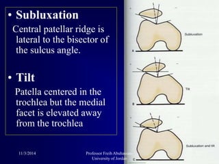• Subluxation
Central patellar ridge is
lateral to the bisector of
the sulcus angle.
• Tilt
Patella centered in the
trochlea but the medial
facet is elevated away
from the trochlea
11/3/2014 22Professor Freih Abuhassan-
University of Jordan
 