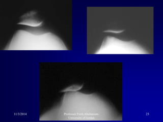 11/3/2014 23Professor Freih Abuhassan-
University of Jordan
 