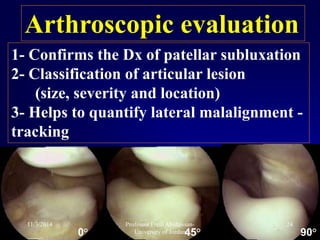 Arthroscopic evaluation
1- Confirms the Dx of patellar subluxation
2- Classification of articular lesion
(size, severity and location)
3- Helps to quantify lateral malalignment -
tracking
°90°45°0
11/3/2014 24Professor Freih Abuhassan-
University of Jordan
 