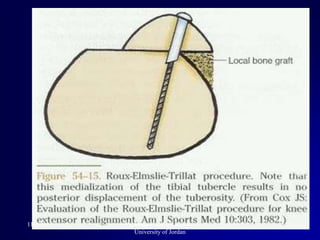 11/3/2014 37Professor Freih Abuhassan-
University of Jordan
 