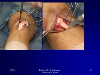 11/3/2014 40Professor Freih Abuhassan-
University of Jordan
 