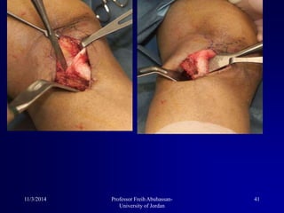 11/3/2014 41Professor Freih Abuhassan-
University of Jordan
 