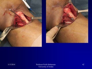 11/3/2014 42Professor Freih Abuhassan-
University of Jordan
 