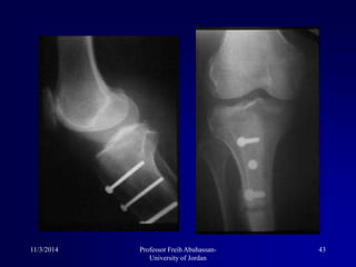 11/3/2014 43Professor Freih Abuhassan-
University of Jordan
 