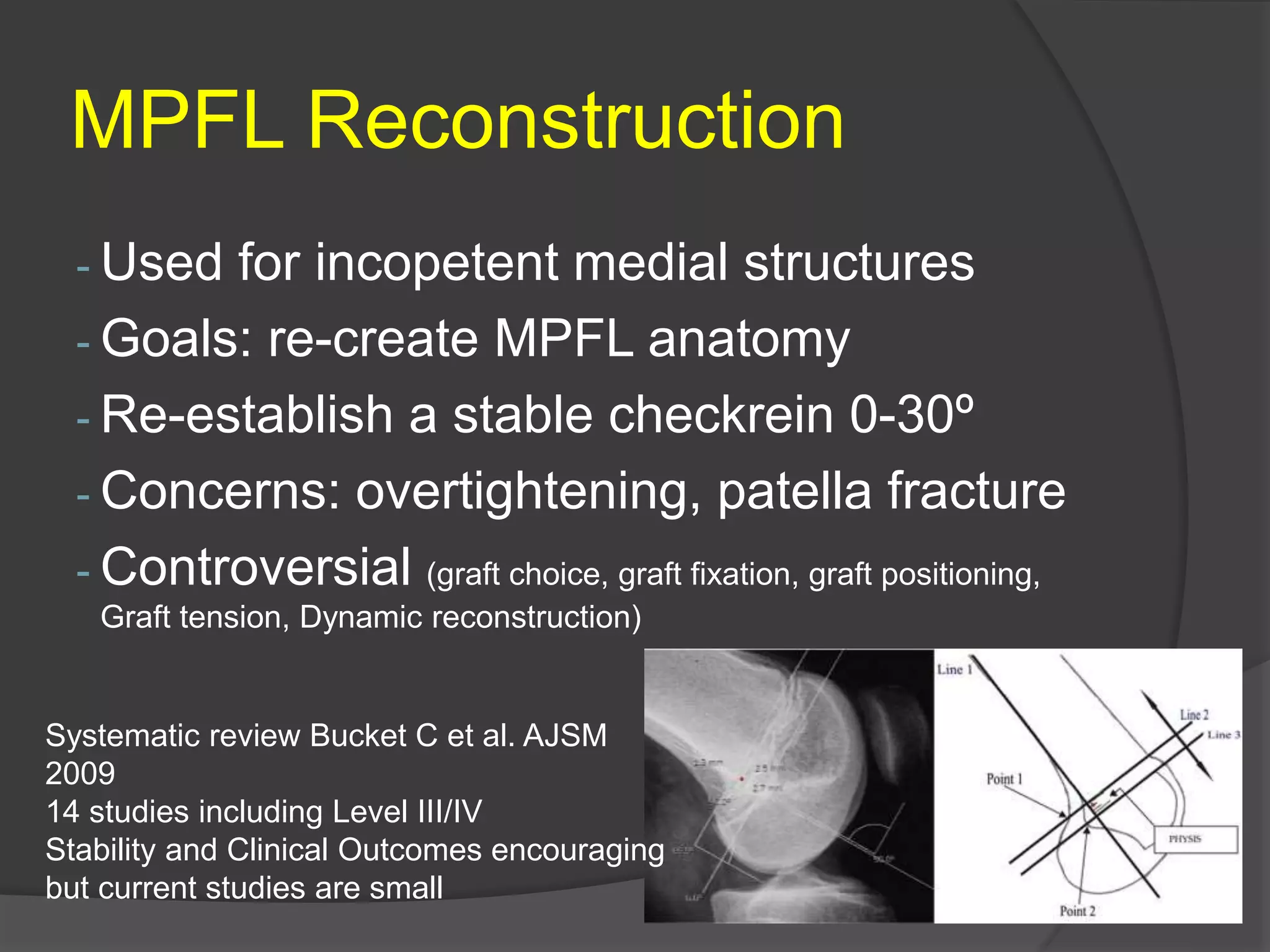 MPFL Reconstruction
- Used for incopetent medial structures
- Goals: re-create MPFL anatomy
- Re-establish a stable checkrein 0-30º
- Concerns: overtightening, patella fracture
- Controversial (graft choice, graft fixation, graft positioning,
Graft tension, Dynamic reconstruction)
Systematic review Bucket C et al. AJSM
2009
14 studies including Level III/IV
Stability and Clinical Outcomes encouraging
but current studies are small
 