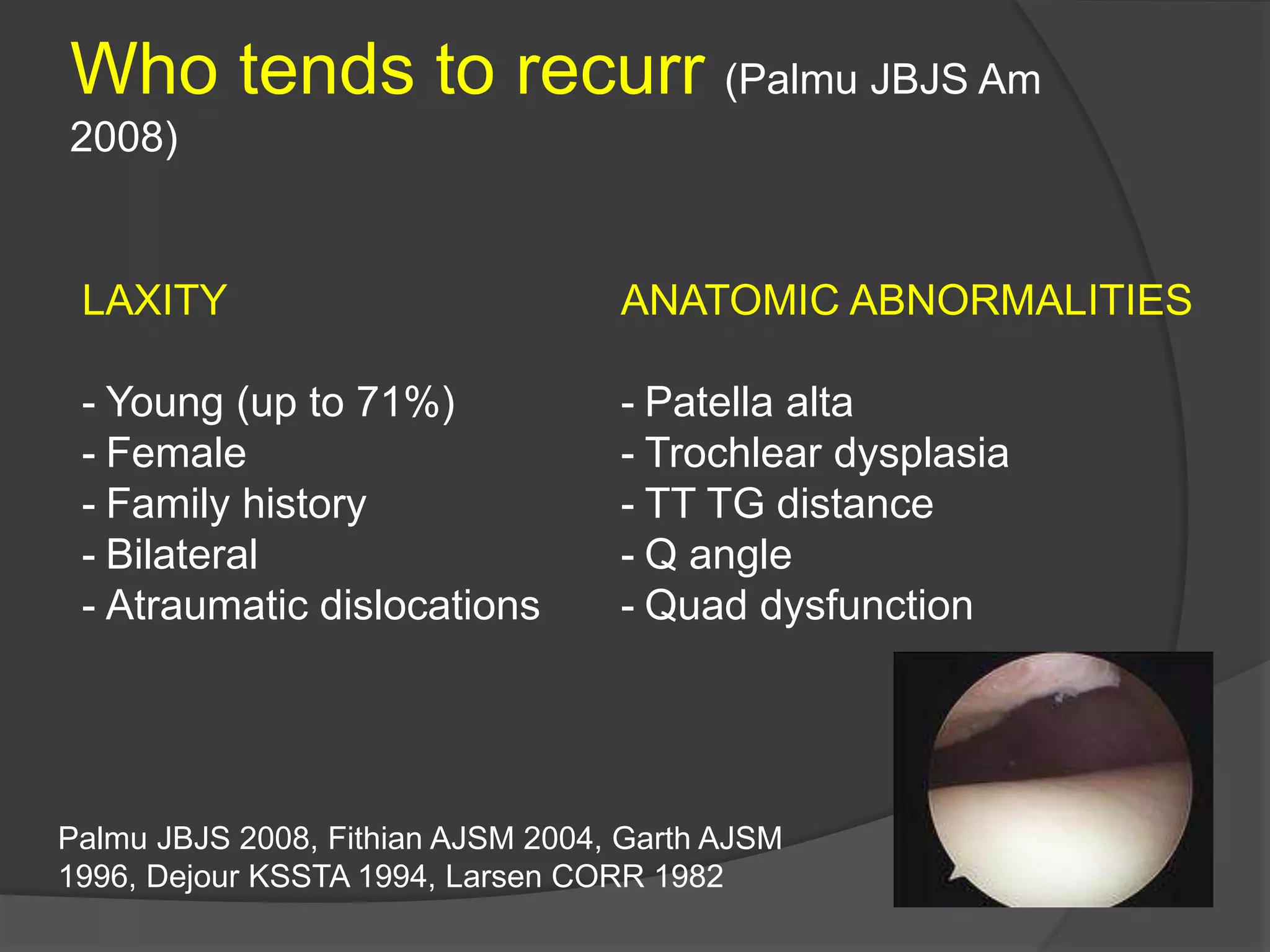 Who tends to recurr (Palmu JBJS Am
2008)
LAXITY
- Young (up to 71%)
- Female
- Family history
- Bilateral
- Atraumatic dislocations
ANATOMIC ABNORMALITIES
- Patella alta
- Trochlear dysplasia
- TT TG distance
- Q angle
- Quad dysfunction
Palmu JBJS 2008, Fithian AJSM 2004, Garth AJSM
1996, Dejour KSSTA 1994, Larsen CORR 1982
 