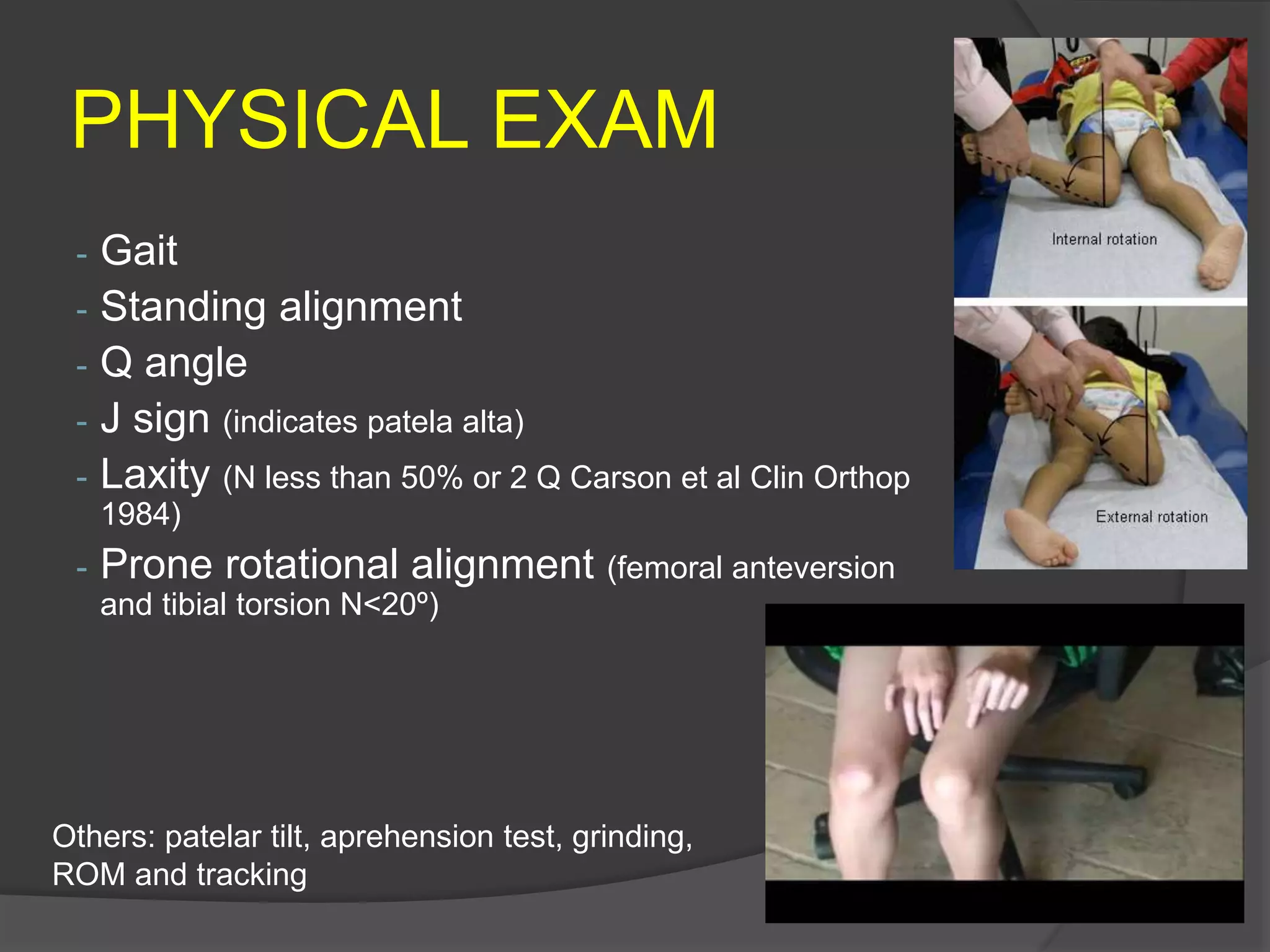 PHYSICAL EXAM
- Gait
- Standing alignment
- Q angle
- J sign (indicates patela alta)
- Laxity (N less than 50% or 2 Q Carson et al Clin Orthop
1984)
- Prone rotational alignment (femoral anteversion
and tibial torsion N<20º)
Others: patelar tilt, aprehension test, grinding,
ROM and tracking
 