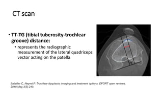 Tt Tg Distance Ct patellofemoral instability.pptx