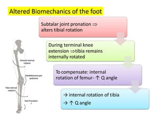 Terminal Rotation Tibia PATELLOFEMORAL PAIN (Harleen kaur Nagi).pptx