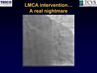 LMCA intervention…
 A real nightmare
 