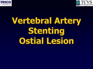 Vertebral Artery
    Stenting
 Ostial Lesion
 