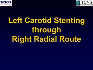 Left Carotid Stenting
      through
 Right Radial Route
 