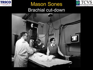 Mason Sones
Brachial cut-down
 