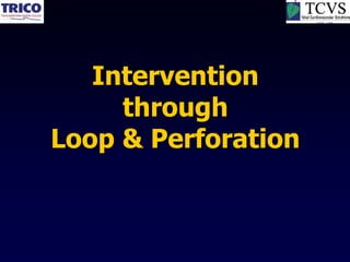 Intervention
     through
Loop & Perforation
 