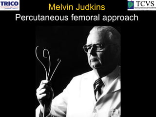 Melvin Judkins
Percutaneous femoral approach
 
