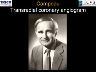 Campeau
Transradial coronary angiogram
 