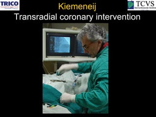 Kiemeneij
Transradial coronary intervention
 