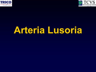 Arteria Lusoria
 