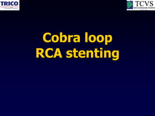 Cobra loop
RCA stenting
 
