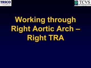 Working through
Right Aortic Arch –
    Right TRA
 