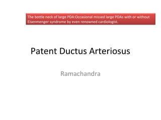 Patent Ductus Arteriosus
Ramachandra
The bottle neck of large PDA:Occasional missed large PDAs with or without
Eisenmenger syndrome by even renowned cardiologist.
 