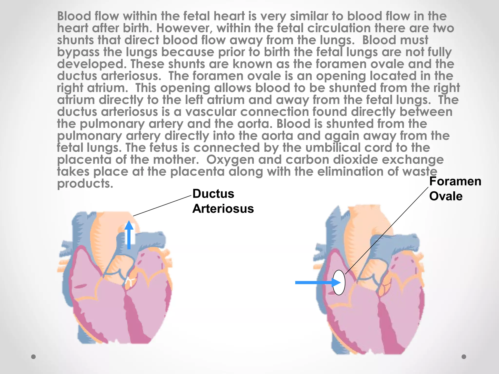 Patent Ductus Arteriosus | PPT