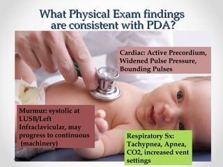 WWhhaatt PPhhyyssiiccaall EExxaamm ffiinnddiinnggss 
aarree ccoonnssiisstteenntt wwiitthh PPDDAA?? 
Murmur: systolic at 
LUSB/Left 
Infraclavicular, may 
progress to continuous 
(machinery) 
Cardiac: Active Precordium, 
Widened Pulse Pressure, 
Bounding Pulses 
Respiratory Sx: 
Tachypnea, Apnea, 
CO2, increased vent 
settings 
 