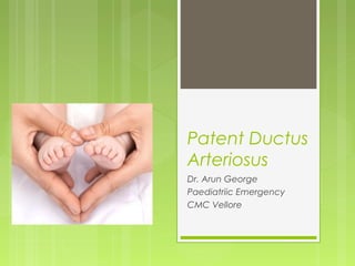 Patent Ductus
Arteriosus
Dr. Arun George
Paediatriic Emergency
CMC Vellore
 