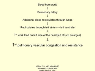 Patent ductus arteriosus | PPT