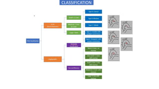 CLASSIFICATION
 