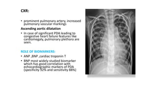 CXR:
• prominent pulmonary artery, increased
pulmonary vascular markings
Ascending aortic dilatation
• In case of significant PDA leading to
congestive heart failure features like
cardiomegaly, pulmonary plethora are
seen.
ROLE OF BIOMARKERS:
• ANP ,BNP ,cardiac troponin T
• BNP most widely studied biomarker
which has good correlation with
echocardiographic markers of PDA
(specificity 92% and sensitivity 88%)
 