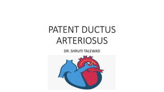 PATENT DUCTUS
ARTERIOSUS
DR. SHRUTI TALEWAD
 