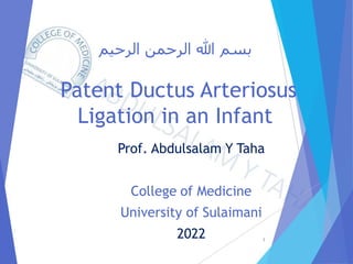 ‫الرحيم‬ ‫الرحمن‬ ‫هللا‬ ‫بسم‬
Patent Ductus Arteriosus
Ligation in an Infant
Prof. Abdulsalam Y Taha
College of Medicine
University of Sulaimani
2022 1
 
