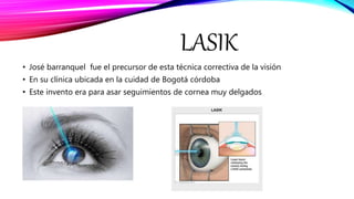 LASIK
• José barranquel fue el precursor de esta técnica correctiva de la visión
• En su clínica ubicada en la cuidad de Bogotá córdoba
• Este invento era para asar seguimientos de cornea muy delgados
 