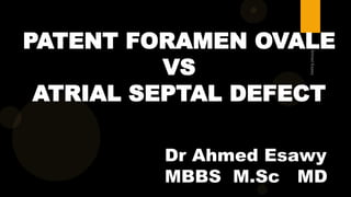 Dr Ahmed Esawy
MBBS M.Sc MD
PATENT FORAMEN OVALE
VS
ATRIAL SEPTAL DEFECT
 