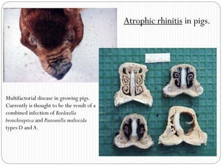 Path 1.1 respiratory illanes | PDF