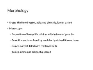 Morphology
• Gross: thickened vessel, palpated clinically, lumen patent
• Microscopy:
- Deposition of basophilic calcium salts in form of granules
- Smooth muscle replaced by acellular hyalinized fibrous tissue
- Lumen normal, filled with red blood cells
- Tunica intima and adventitia spared
 