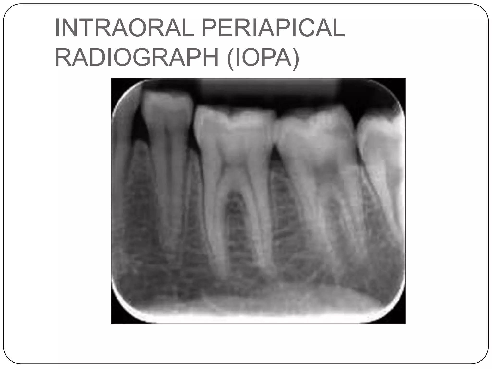 Pathfinder health india pvt ltd pptx PPT