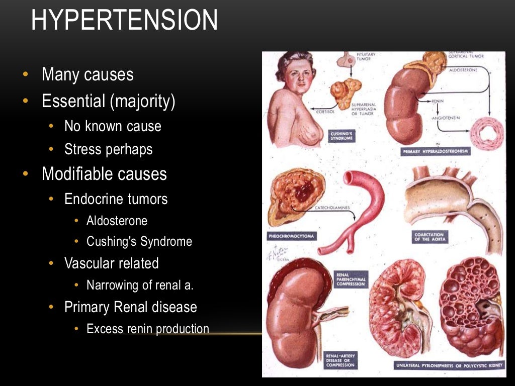 cardiac pathology