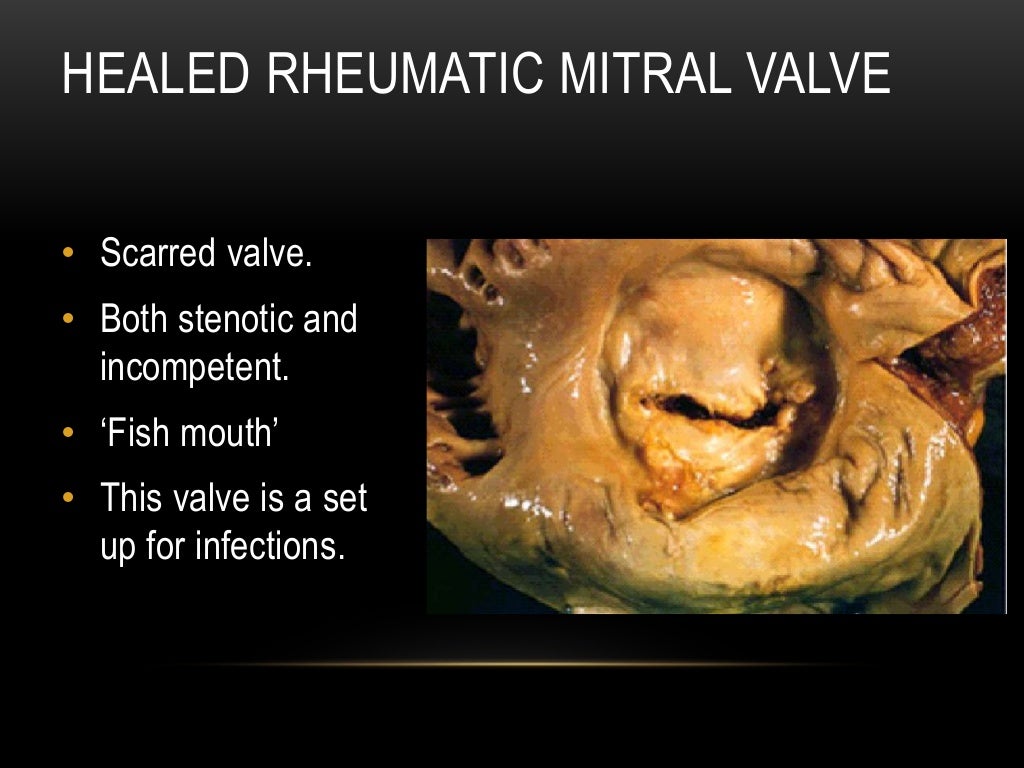 cardiac pathology